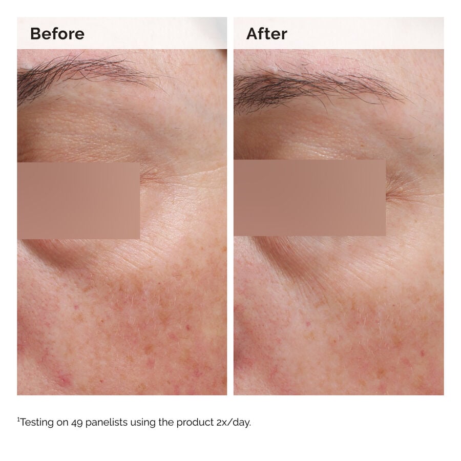 niacinamide-5-face-and-body-emulsion-t3 2024-08-23-ORD-Nia-5pct-Face-Body-B-A-Elasticity-Global-02-1x1.jpg
