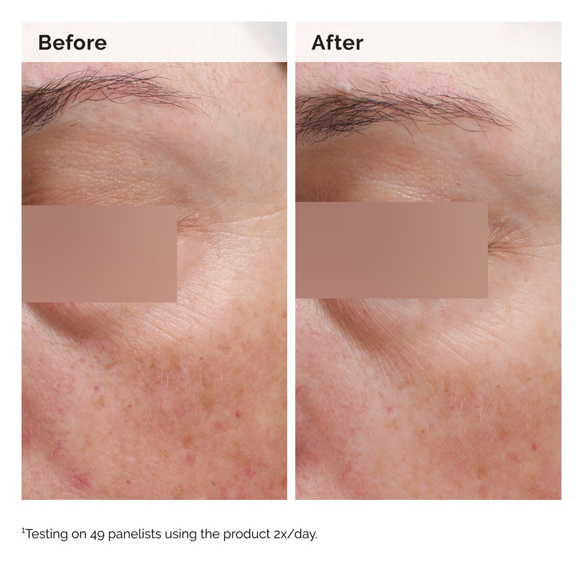 niacinamide-5-face-and-body-emulsion-t3 2024-08-23-ORD-Nia-5pct-Face-Body-B-A-Elasticity-Global-02-1x1.jpg