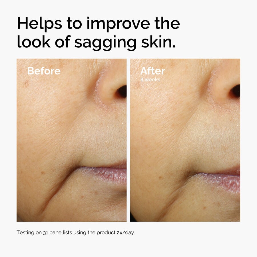 caffeine-3-escin-1-face-serum-r3 ord-caffeine-3pct-escin-1pct-face-serum-before-after-sagging.jpg