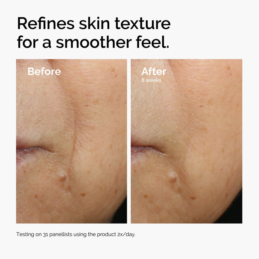 caffeine-3-escin-1-face-serum-r3 ord-caffeine-3pct-escin-1pct-face-serum-before-after-texture.jpg