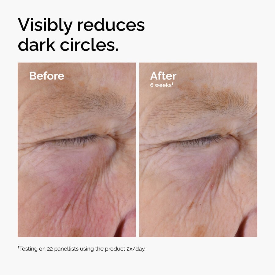 caffeine-solution-5-egcg-eye-serum-l0 ord-caffeine-solution-egcg-dark-circles-before-after.jpg