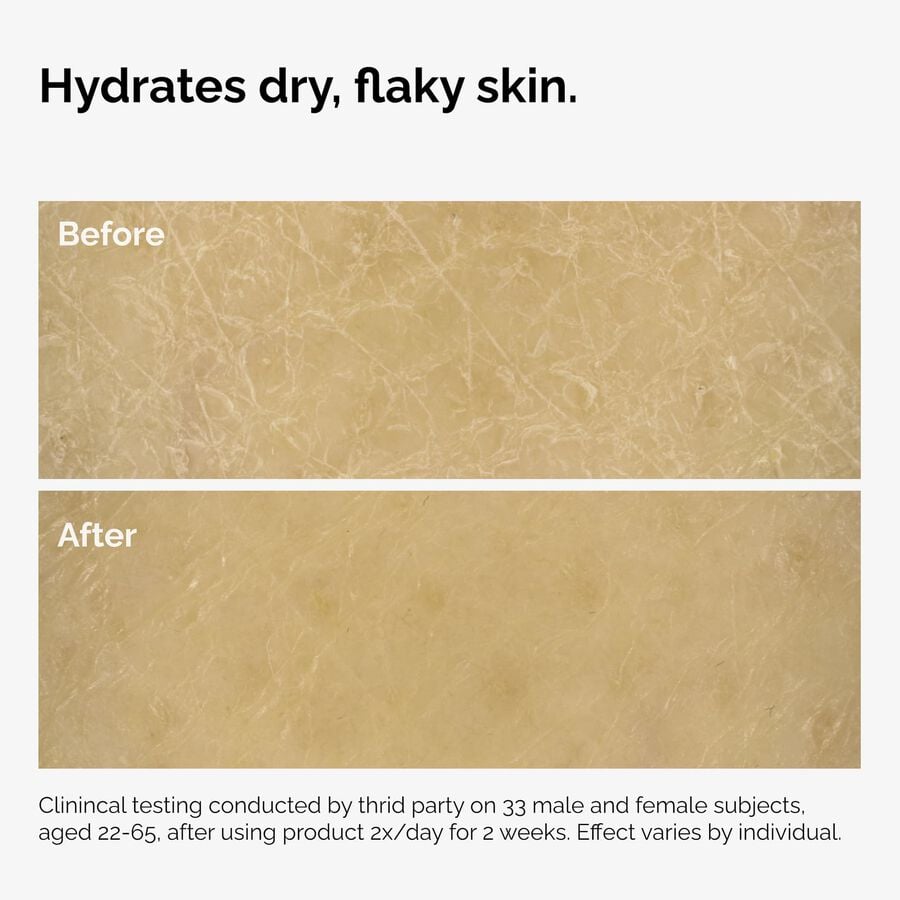 the-body-care-collection-z6 ord-natural-moisturizing-factors-inulin-body-before-after-graphic-02.jpg