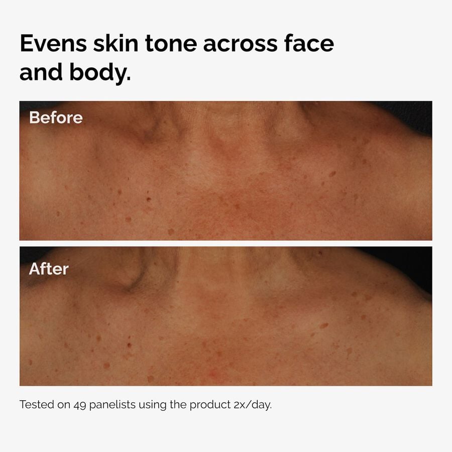 the-body-care-collection-z6 ord-niacinamide-face-body-serum-before-after-even-tone-graphic.jpg