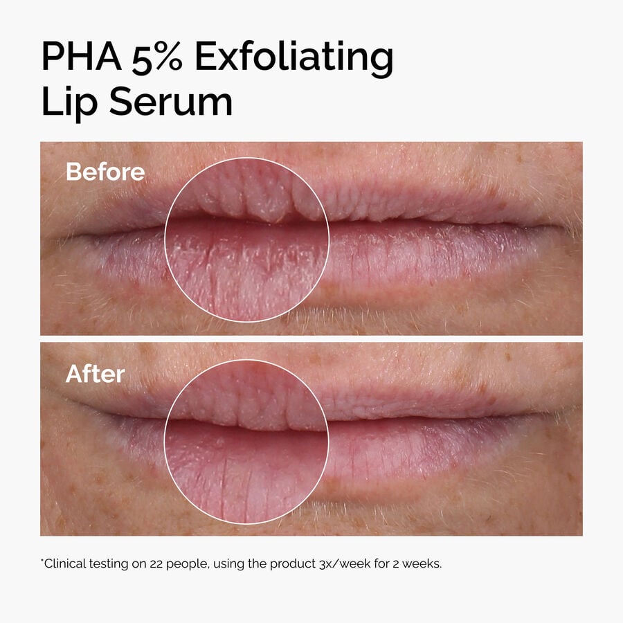 pha-5-exfoliating-lip-serum-l1 ord-pha-5pct-lip-exfoliating-serum-before-after.jpg