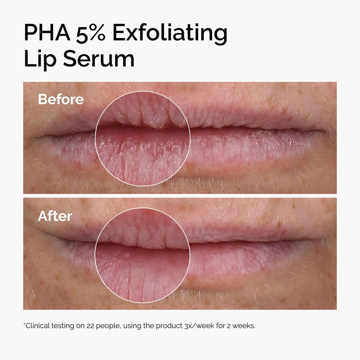 pha-5-exfoliating-lip-serum-l1 ord-pha-5pct-lip-exfoliating-serum-before-after.jpg