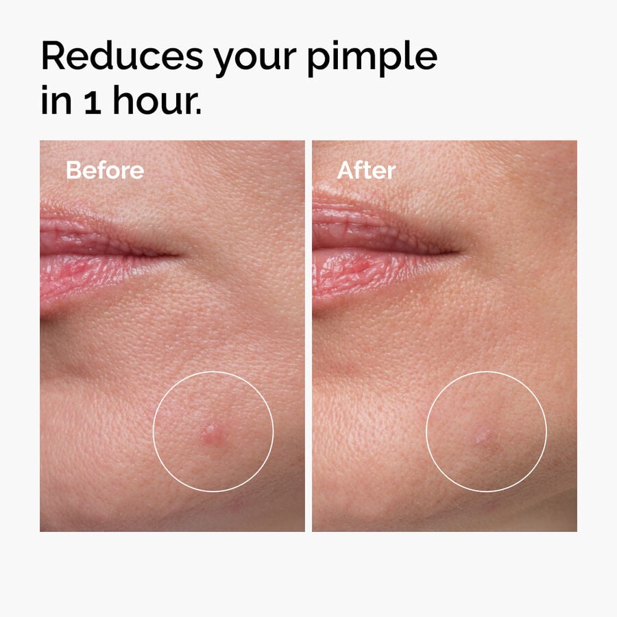 sulfur-10-powder-to-cream-concentrate-a0 ord-sulfur-10pct-powder-to-cream-concentrate-before-after-NA.jpg